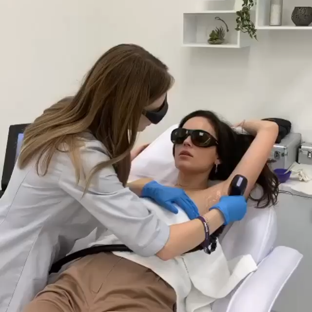 laser hair removal treatment