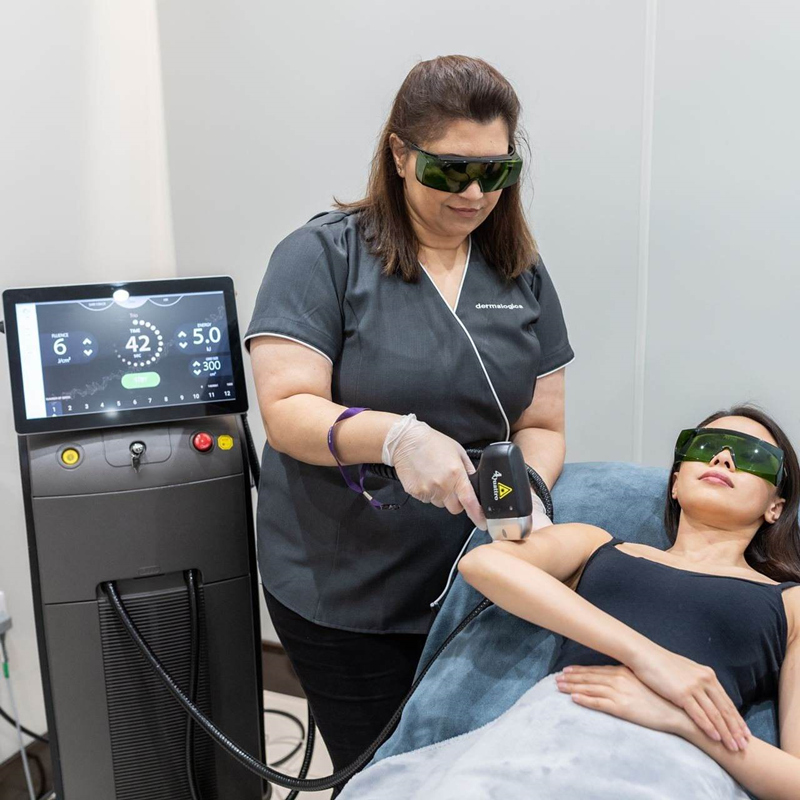 laser hair removal treatment at medical spa