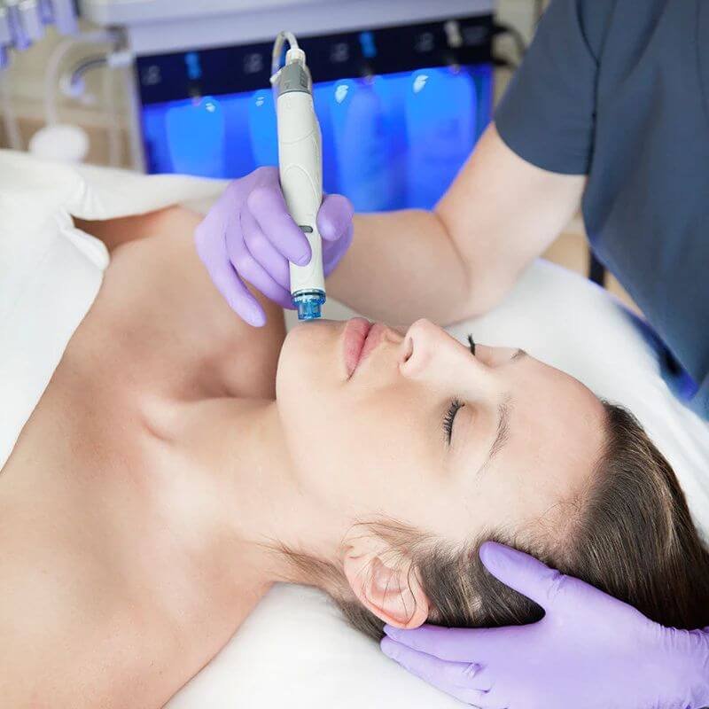 Hydrodermabrasion skin peeling