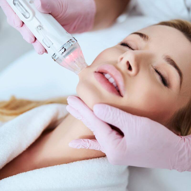 Microneedle RF Skincare