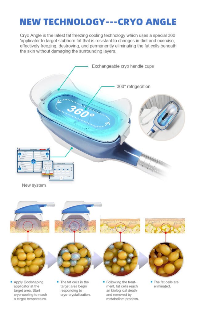 how does 360 cryolipolysis work