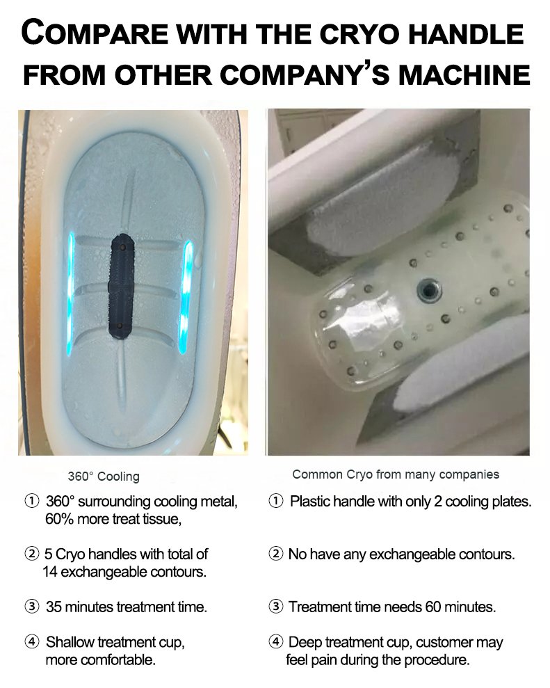 360 cryolipolysis Vs old cryolipolysis