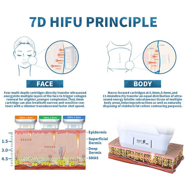 how does 7d hifu work