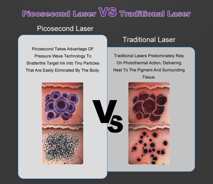 Q-Switched Nd: YAG Lasers