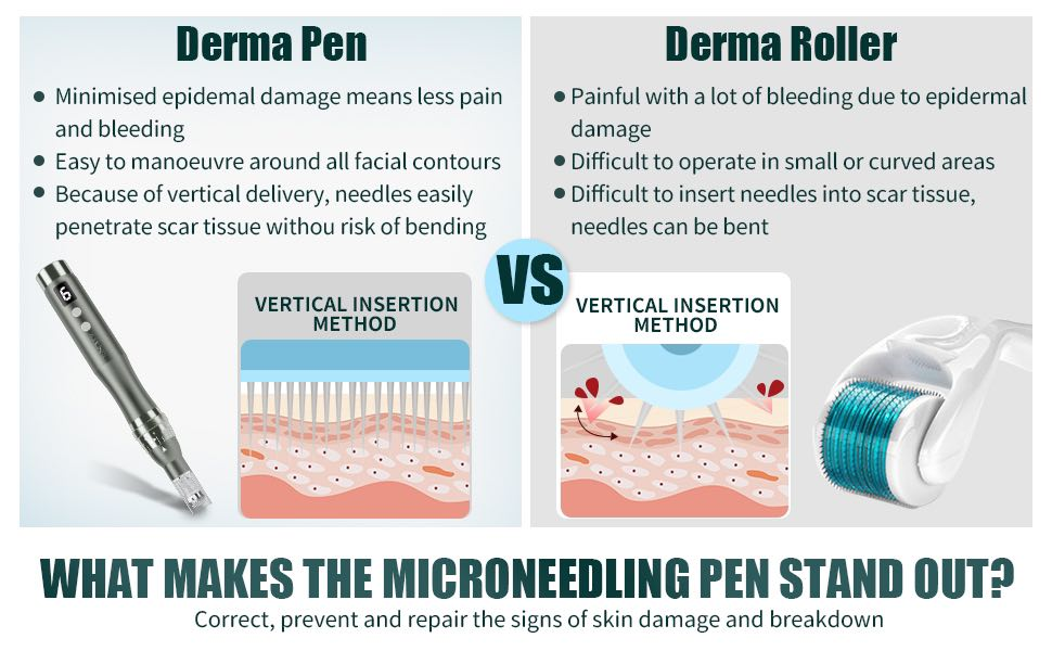 derma pen vs derma roller