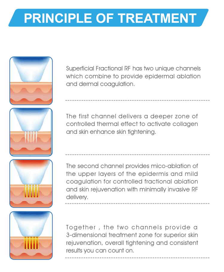 gold microneedling fractional rf work priciple