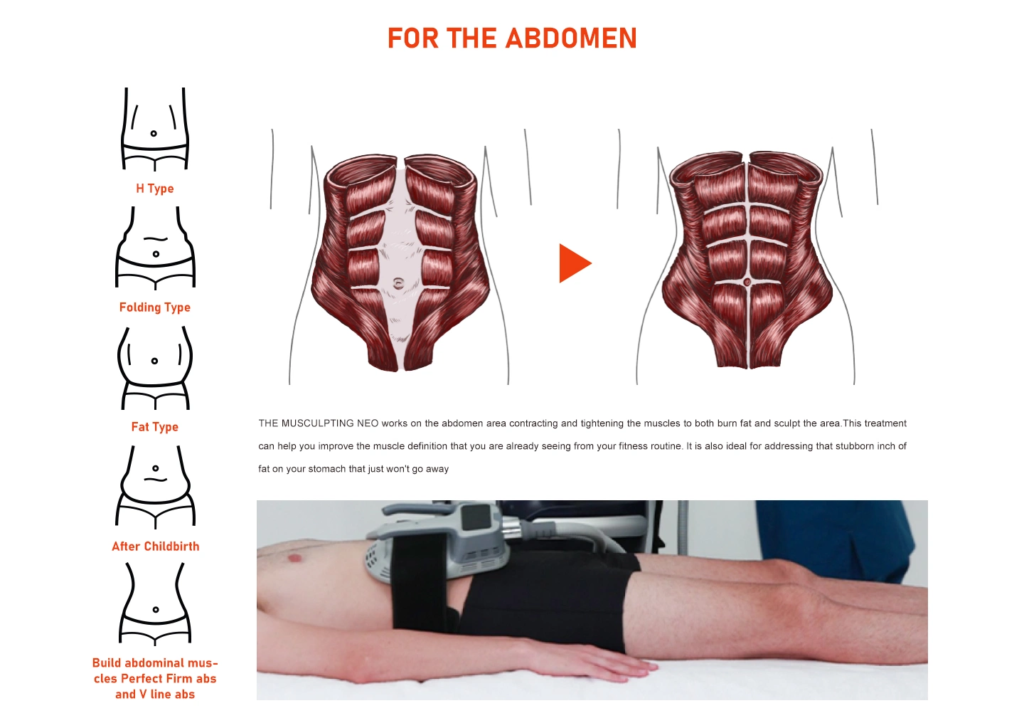 EMS stimulation Improve separation of rectus abdominal muscles.