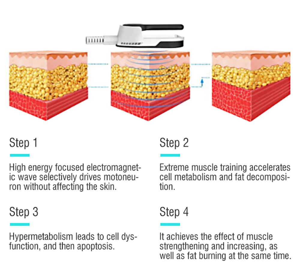 Emsculpt Neo Muscle Building Body Contouring Working