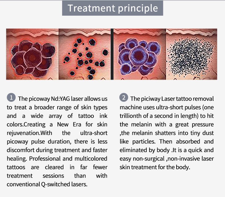 picoway treatment principle