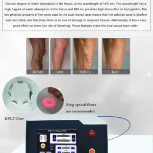 980nm laser (2)