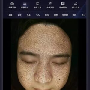 Aisia 3D Digital AI Smart Facial Skin Analyzer​ - Image 7