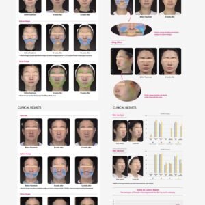 Volnewmer effect