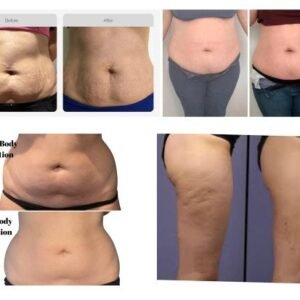 kim 8 slimming system before and after