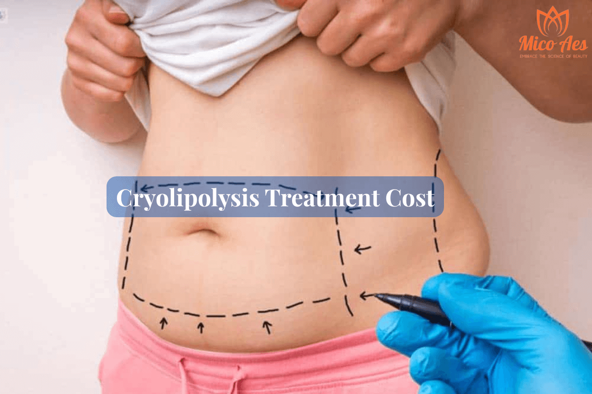 How-Much-Does-Cryolipolysis-Treatment-Cost